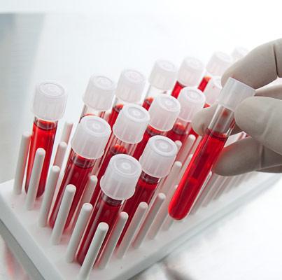 Сдача биохимического анализа крови